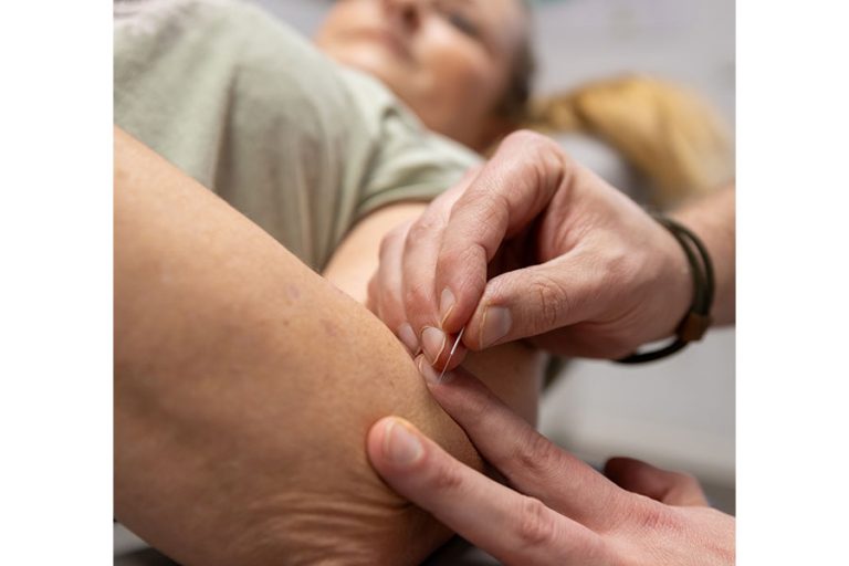 Tobias Bohle Chiropraktik Garbsen Akupunktur 768x512